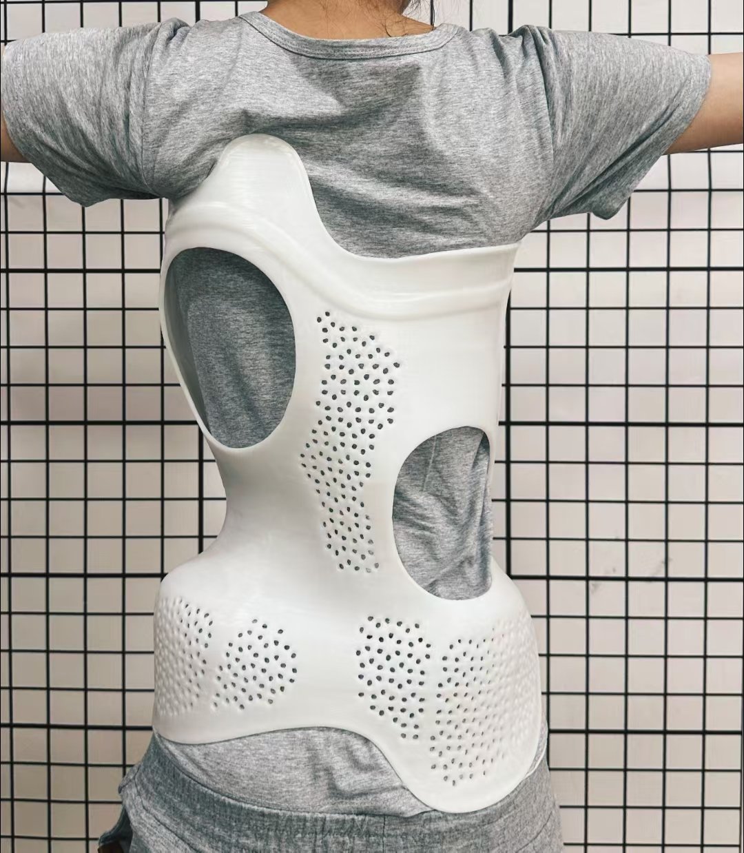 脊柱側(cè)彎矯正器的作用