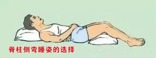 睡姿不正確會對脊柱側(cè)彎產(chǎn)生影響嗎？